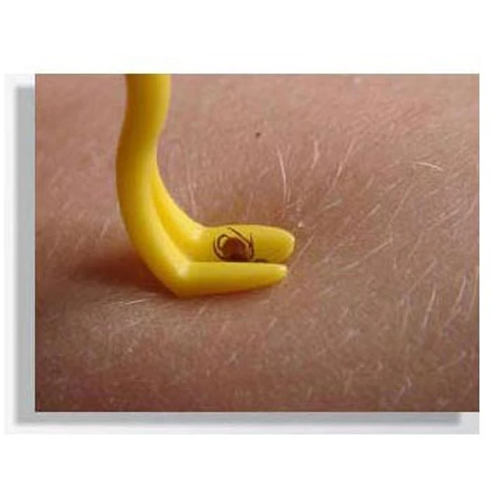 OTOM Zeckenhaken Tick Twister, Für Mensch Und Tier, Set Mit 0,1 Mm Und 0,4 Mm, Kunststoff 3 OTOM Zeckenhaken Tick Twister, Für Mensch Und Tier, Set Mit 0,1 Mm Und 0,4 Mm, Kunststoff – Bild 3