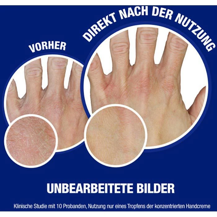 Neutrogena Handcreme Norwegische Formel, 75ml, Sofort Einziehend, Für Trockene Und Rissige Hände 3 Neutrogena Handcreme Norwegische Formel, 75ml, Sofort Einziehend, Für Trockene Und Rissige Hände – Bild 3